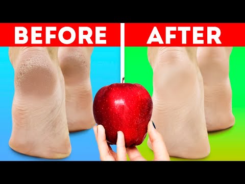 Natural Beauty Hacks For Everyone