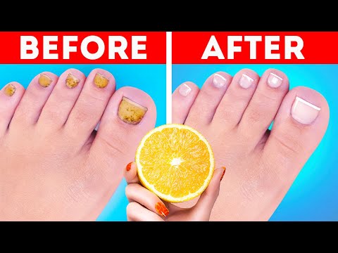 Clever hacks to take care of your feet