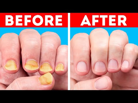 Stunning Manicure Ideas And Nail Hacks That You Will Adore