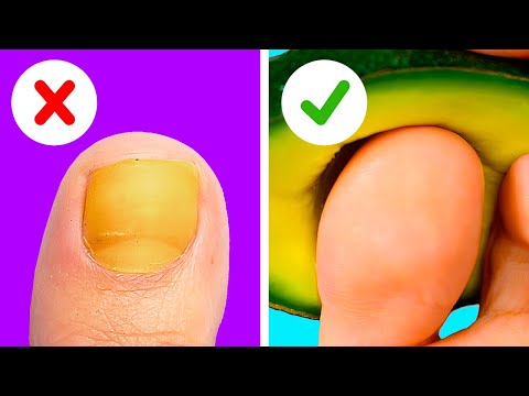Awesome Feet Hacks Pedicure Techniques