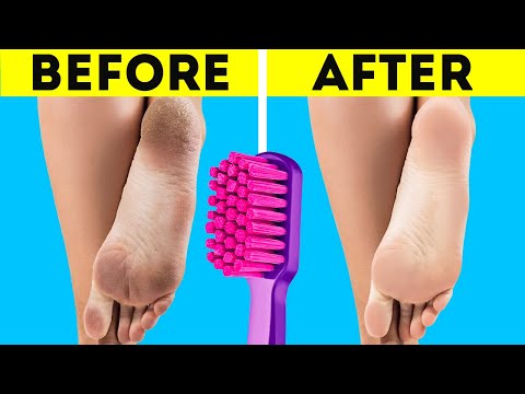 Amazing hacks for healthy and beautiful feet