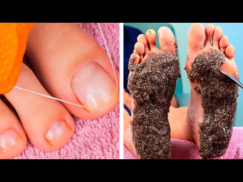 Awesome pedicure hacks that your feet will love!