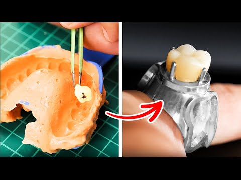 I made a ring with my girlfriend's tooth! Cheap Jewelry ideas