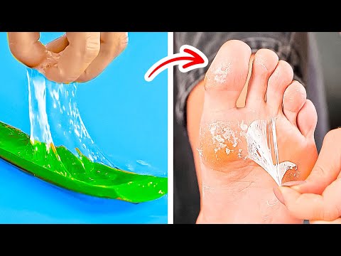 Useful hacks to make your feet feel great!