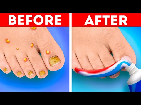Smart feet care hacks and pedicure tricks you can easily repeat at home