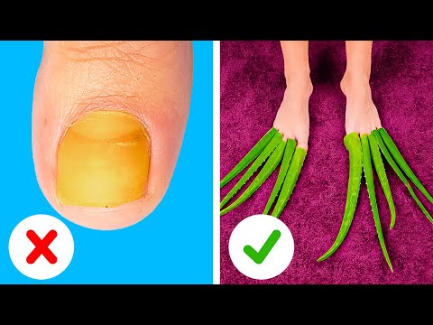 Smart feet care hacks to make them look flawless!