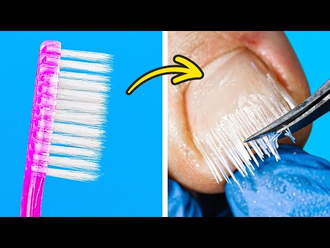 Fantastic nail hacks you can't miss!