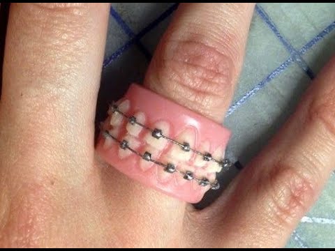 Teeth in braces ring diy craft 🌸 #shorts