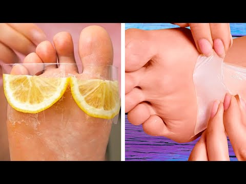 Simple hacks for your shoes and feet!