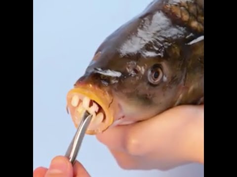 🌸 DIY Braces Ring: Crafting a Unique Teeth-Inspired Accessory 🦷💍 #shorts