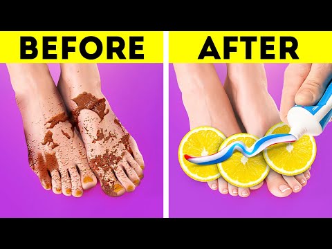 Simple pedicure and feet hacks you should know about