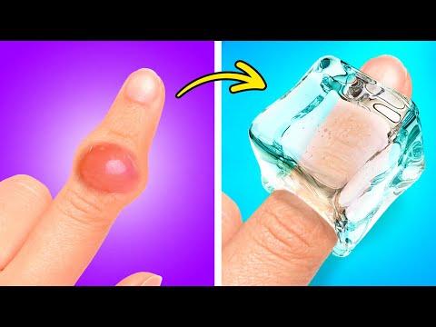 20+ Little-Known Emergency Hacks You Absolutely Need in Your Life!