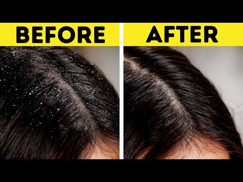 Gorgeous Hair Naturally! 🌿 DIY Hacks Every Girl Needs to Try