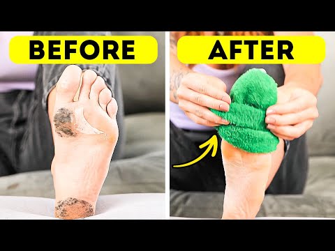 Feet Ready for Summer? Try These Easy Glow-Up Hacks! 💅👡 #footcare