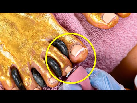 Say Goodbye to Dry Feet! 💧✨ Summer Foot Hacks You Need #beautyhacks