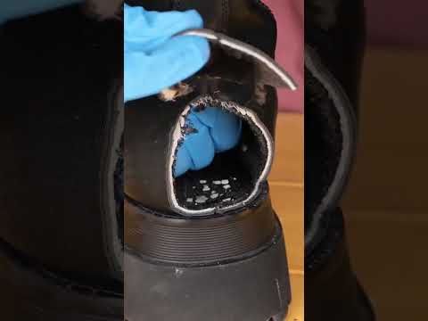 I would never throw my caps for teeth again 🦷 I'd do THIS! #diy #shoes