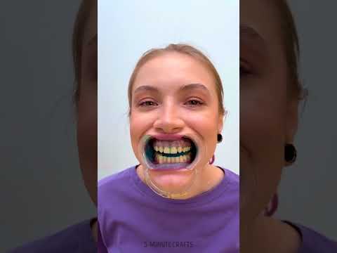 Oral Dental Irrigator for Teeth Cleaning To Smile Widely 😁 😁