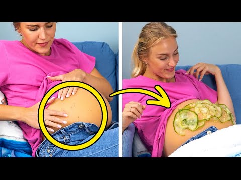How to Get Rid of Stretch Marks? +Other Hacks Every Mom-to-Be Will Love 🤰💡