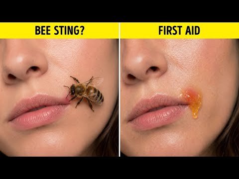 Grandma’s Secret Natural Remedies and Hacks That Still Work Today 🌿